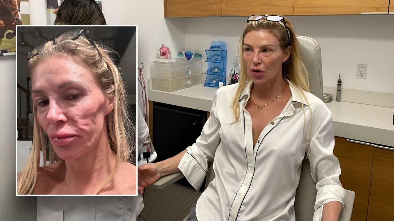 Brandi Glanville believes her face was attacked by a parasite, while Terry Dubrow calls her a "ticking time bomb."