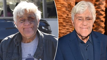 Despite having a bruised face from a fall, Jay Leno is reportedly feeling well.