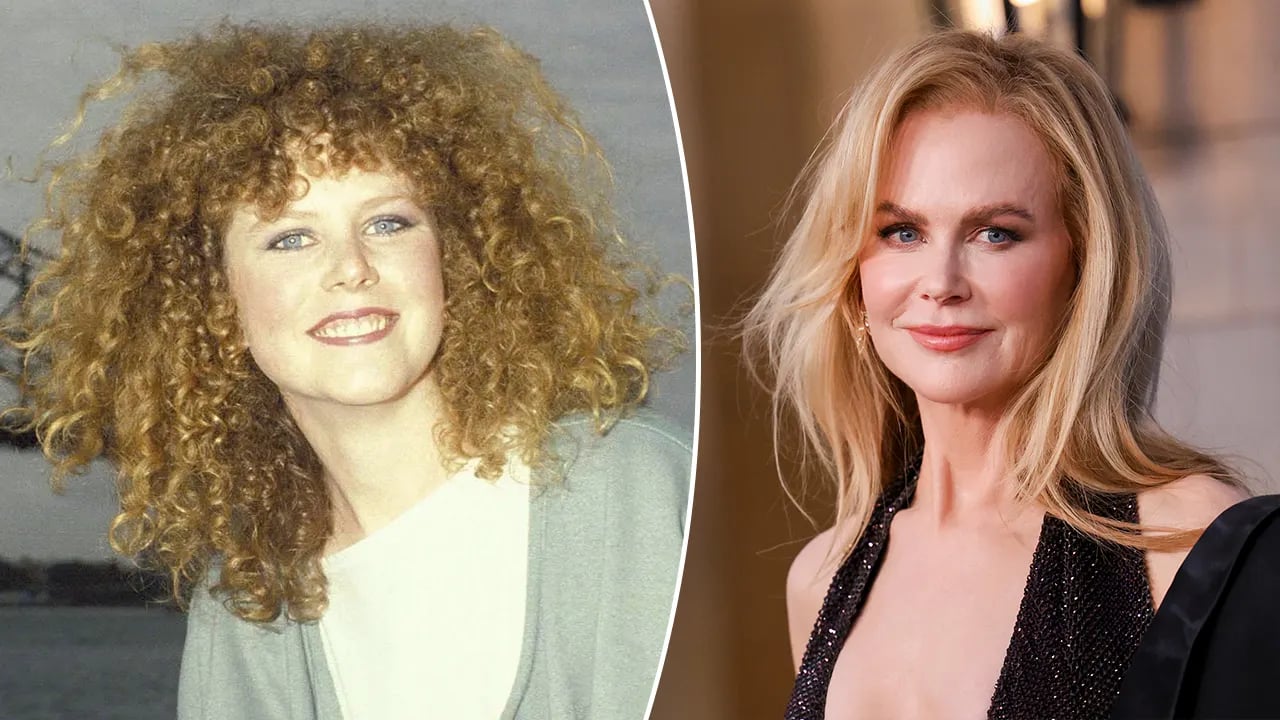 As a teenager, Nicole Kidman struggled with body image issues and faced teasing from others.