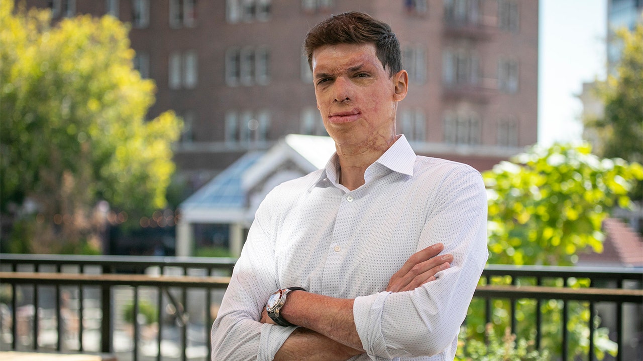 In a top battleground Senate race, Sam Brown, a war veteran, emerges victorious in the GOP primary.