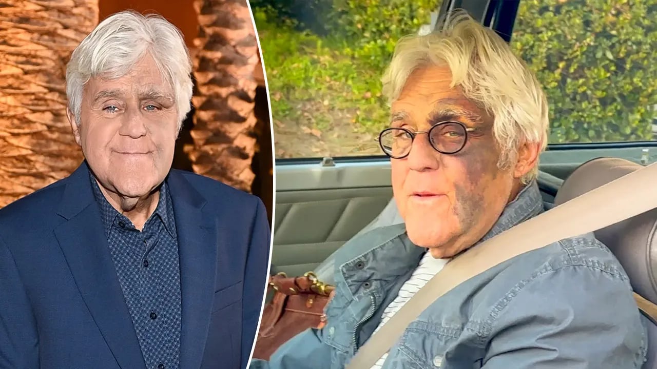 Jay Leno denies rumors that his facial injuries were due to mob retaliation.