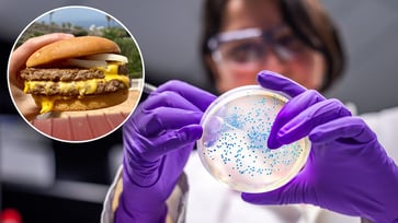 McDonald's Burgers Linked to E. coli Outbreak: Identifying Symptoms