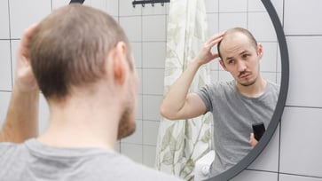 A study suggests that sugar stored in the body could be a potential cure for men's hair loss.