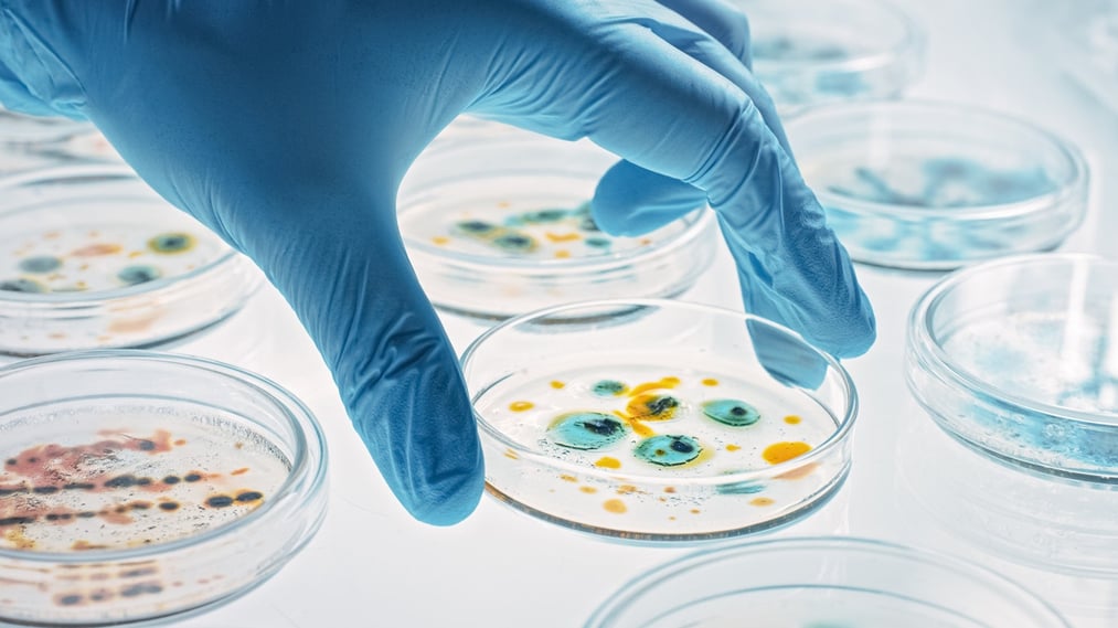 A large study has found that superbugs resulting from antibiotic resistance could lead to the deaths of approximately 39 million individuals by the year 2050.