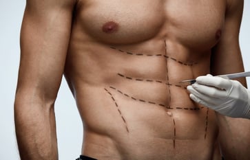 The demand for six-pack surgery is increasing among men, according to plastic surgeons.