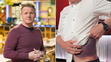 Gordon Ramsay recounts the bike accident that resulted in him being bloodied and experiencing blurred vision.