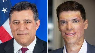 The GOP primary in a swing state has ended, and now voters will determine who will challenge the tough Democrat incumbent.