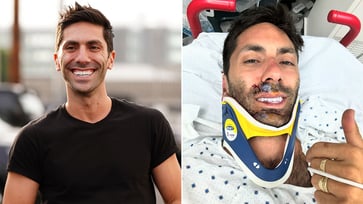 Nev Schulman, host of 'Catfish,' is fortunate to be alive after breaking his neck in a bike accident.